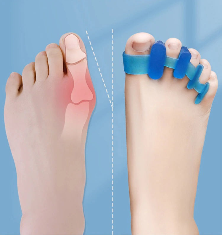 Foot and Posture Correcting Toe Separators